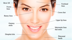 Botox and Dysport Treatment Areas: